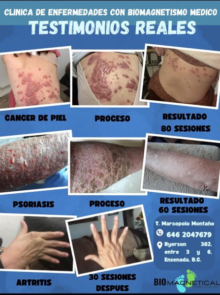 TESTIMONIOS REALES